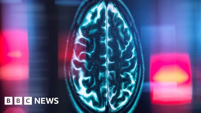 Scientists pinpoint the brain's internal mileage clock Scientists pinpoint the brain's internal mileage clock